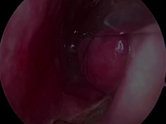 Probe Neurologi Ultra-Kecil dan Fleksibel PLA407